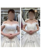 ライズ/デコルテのビフォーアフター