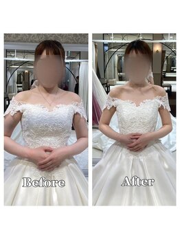 ライズ/デコルテのビフォーアフター