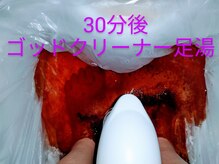 ゴッドクリーナー足湯30分4000円★代謝促進・排出デトックス