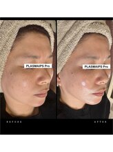 ワイケー(yk)/プラズマ×エクストリュージョン