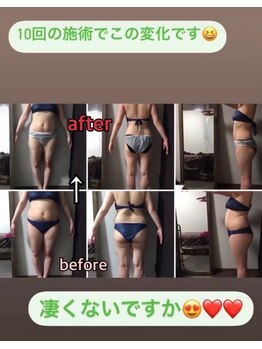 アンリール 苫小牧店(ANRIRE)/ボディー施術のお客様です