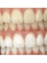 ホワイトニングセンター 沖縄コザ店/うるま市・沖縄市ホワイトニング