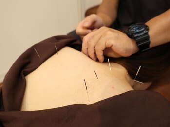 鍼灸院 快笑(cocoroe)の写真/【本格整体×鍼灸で根本改善☆】首肩腰の痛み/姿勢の歪み/疲れやすさを感じている方必見!