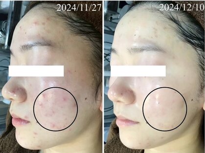 イーヴィック ツシンマチ(E-Vik Tsushinmachi)の写真