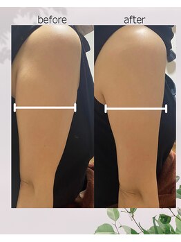 エノア(ENOA)/レッドショット二の腕