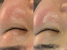 アロマビューティーサロン ジェイハウス(J)/