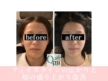 キュープ 京都店(Qpu)/お客様ビフォーアフター