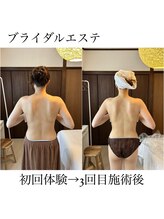 イム(I'm.)/ブライダル before/after