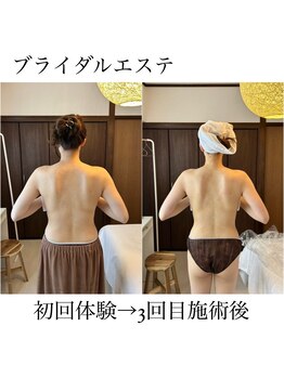 イム(I'm.)/ブライダル before/after