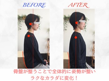 タイナ 岡山(taina)/猫背・巻き肩矯正