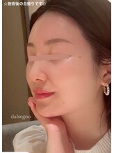 ダルセーニョ/ダルセーニヨ　ボンバーコルギ