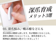 モーダアッカ(moda acca)/深爪悩み、噛み癖などにも