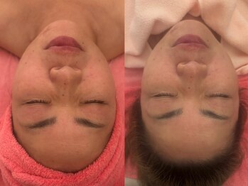 サロンドデュイ/1回施術/50代/エステ四日市