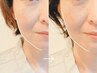【リフトアップコース】「シワくすみが消えた～♪」育毛促進ヘッドスパ9900円