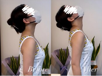 ハクト(Hakuto)/Before/After