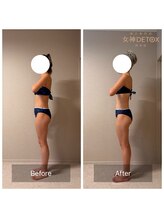 女神デトックス 西宮店(女神DETOX)/ビフォーアフター
