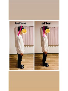 カラダリリース 浜松店/姿勢改善例