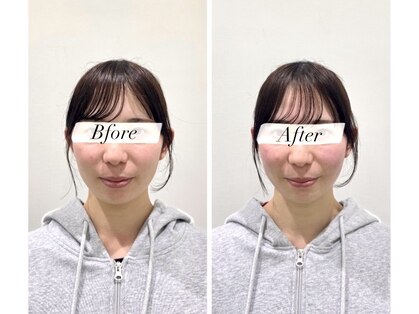 ノモコツ鍼灸 整骨院 赤羽スズラン通り院(NOMOKOTSU鍼灸 整骨院)の写真