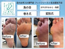 フットファースト 名古屋池下店