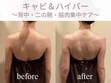 エステティックサロン アールグレー 名古屋駅店/大人気◎背中の印象が変わる！？