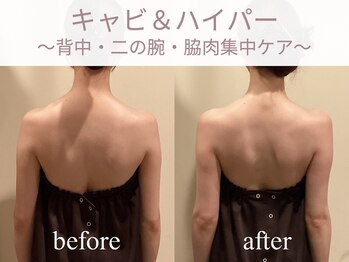 エステティックサロン アールグレー 名古屋駅店/大人気◎背中の印象が変わる！？