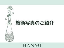 韓美 表参道店(HANMI)/施術写真のご紹介です