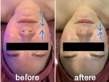 エステティックジュネス(JEUNESSE)/シークレットフェイシャル