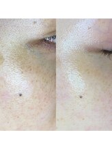 ミーミー 多治見店(MeMe.)/