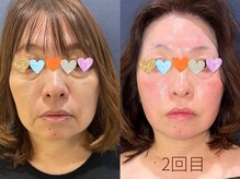 美々永 ビビッド(vivid)の雰囲気(まるで別人、信じられない…そんな方にこそぜひ体験してほしい)