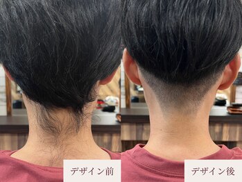 クラームビューティー(Clerm beauty)/美容師によるうなじデザイン脱毛