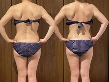 イーネ オランジェ 八王子店/本気の方向けサロンです