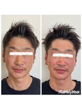 ケアラボ(Care Labo)/【谷口美容鍼】