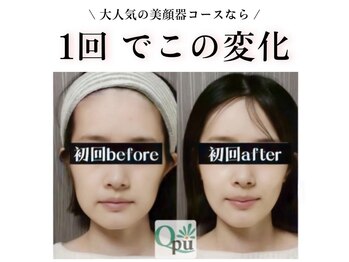 キュープ 鹿児島伊集院店(Qpu)/美顔器コース初回での変化です