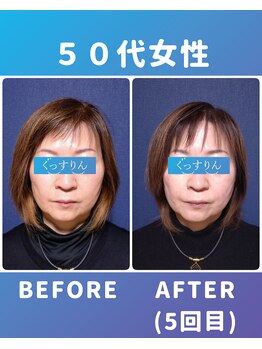 ぐっすりん/複数回継続のお客様の変化(3)