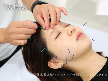 アロエ鍼灸整体院/美容鍼で肌トラブル改善