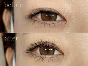 シェノン(Chainon)の写真/まつエクだけ。まつげパーマだけ。の時代はもう終わり！【&Healthy】で理想の目元へ☆