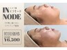 【エステ版インモード】ほうれい線/リフトアップ/たるみ改善13000円→6500円