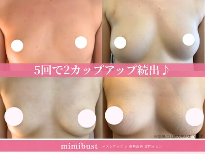 ミミバスト(mimibust)の写真
