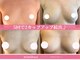 ミミバスト(mimibust)の写真