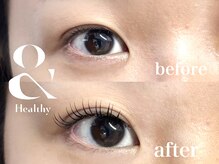 リノモア(LinoMoa)/＆healthy(アンドヘルシー)