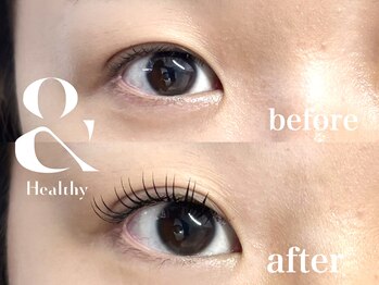 リノモア(LinoMoa)/&healthy(アンドヘルシー)