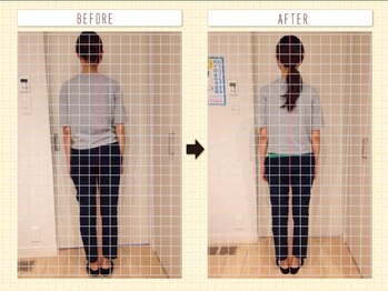 ルクラ(Lucura)/骨盤調整で姿勢改善