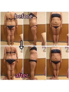 アンリール 苫小牧店(ANRIRE)/ボディー施術のお客様です