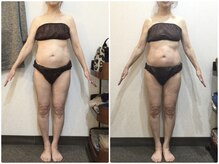 美容整体ウェリナ 名駅院/小顔矯正/骨盤矯正/美脚サロン