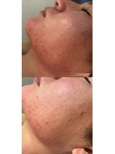 アロマビューティーサロン ジェイハウス(J)/