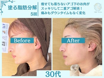 フローフシ∞/【小顔】塗る脂肪分解&燃焼