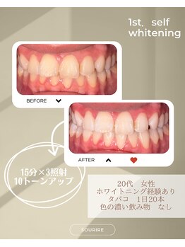 スリール(sourire)/