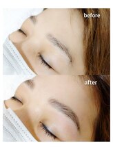 マツ(MATSU)/【ハリウッドブロウリフト】