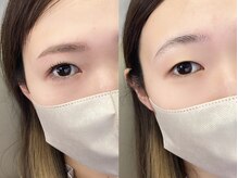 チルアンドアイ 千葉駅前店(Chill&Eye)/美眉スタイリング/BeforeAfter