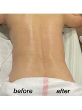 スパークリングセルフ(Sparkling Self)/ボディ施術